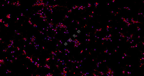 3.11神经元3 IF PLLL-tubulin红+GFAP绿_20.0x-1.jpg