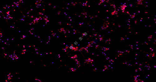 3.11神经元3 IF PLLL-tubulin红+GFAP绿_20.0x-2.jpg