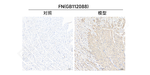 37 IHC-1.png