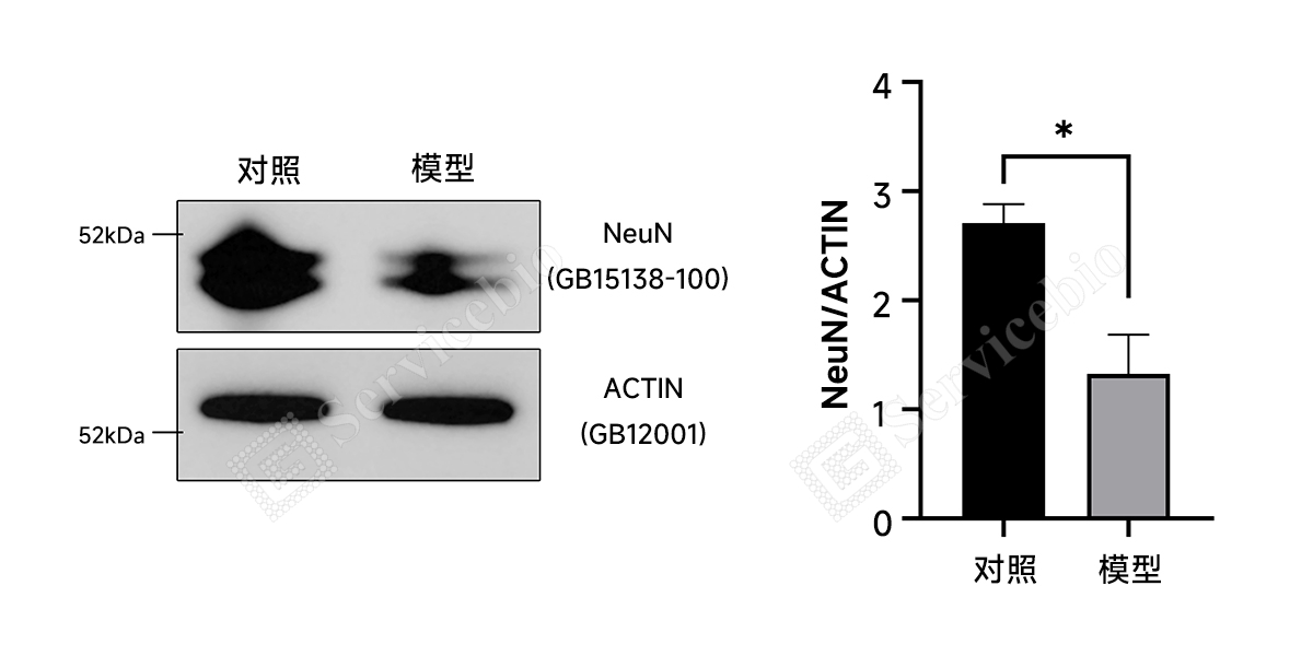 YA1128-大鼠脑缺血再灌注-WB（NeuN）.jpg