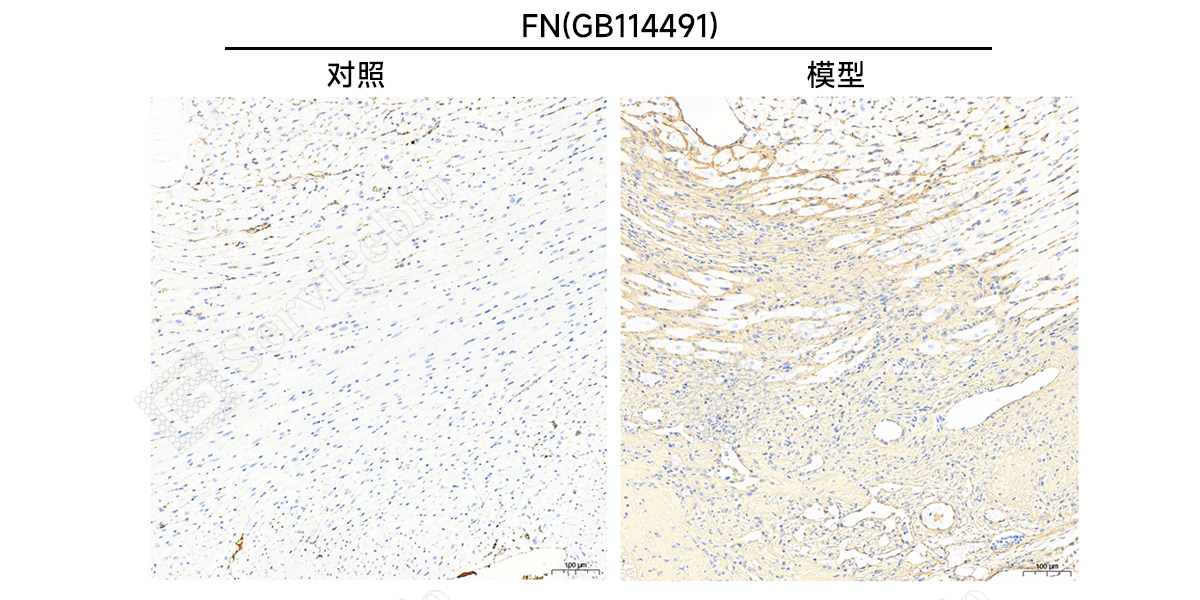 9、IHC（FN）.jpg