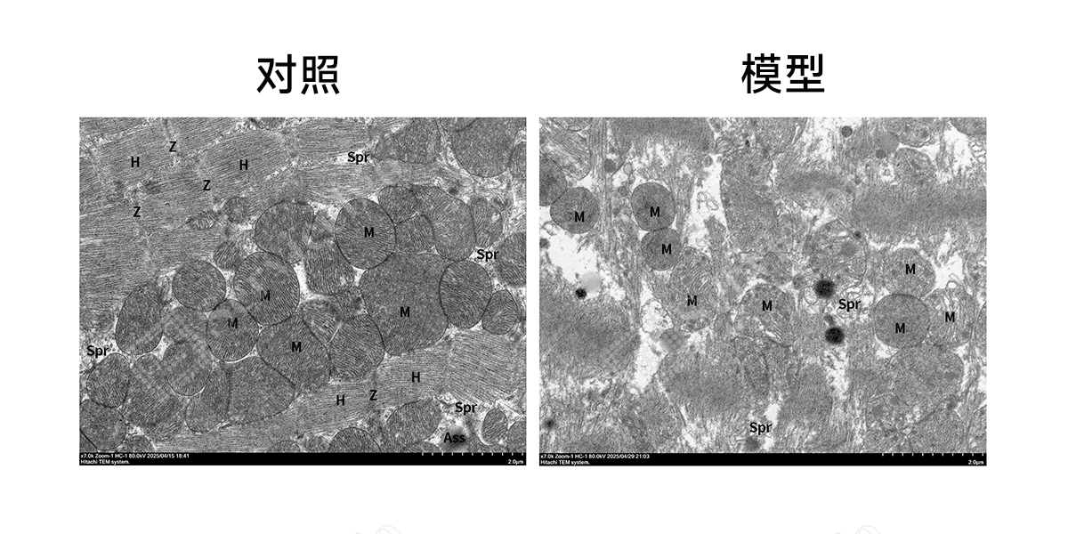 (3)YA1126-小鼠心肌缺血再灌注模型-透射电镜.png