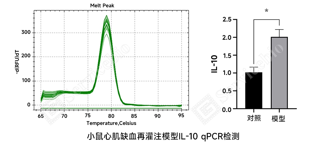 小鼠心肌缺血再灌注模型IL 10 qPCR检测.jpg