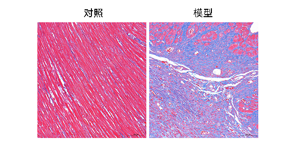 34-masson染色.jpg