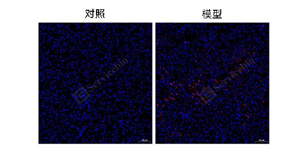 29-TUNEL染色.jpg