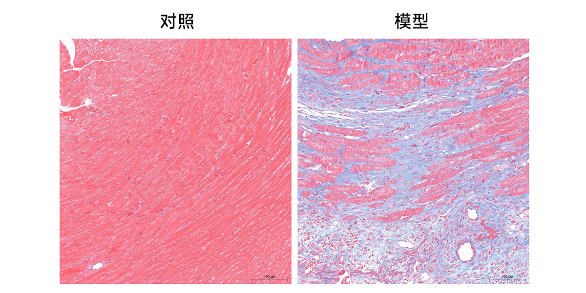 6、masson染色.jpg