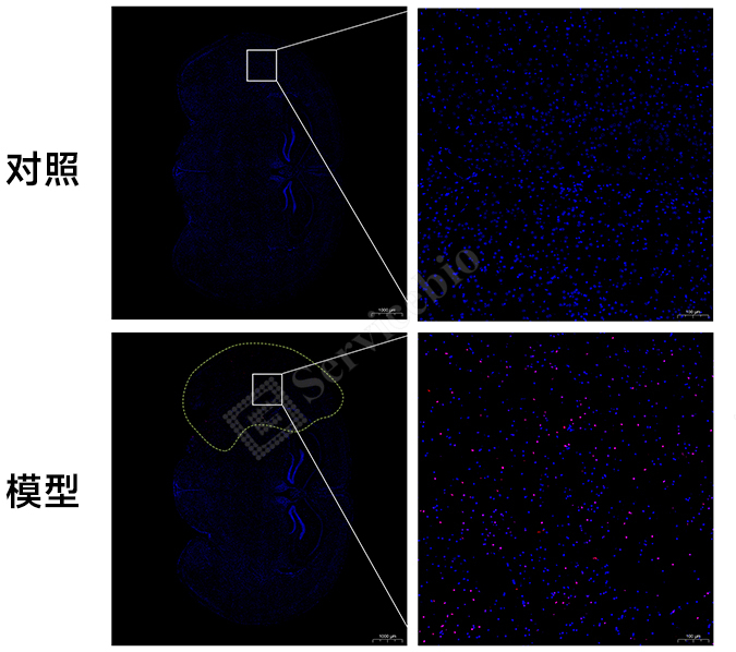 7、TUNEL组图-1.jpg 7、TUNEL组图-1.jpg
