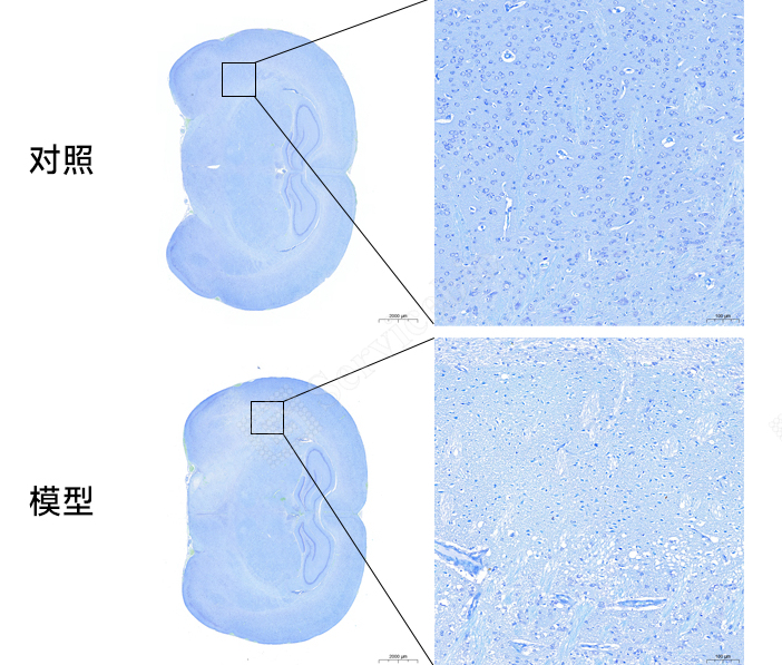 尼氏染色.jpg