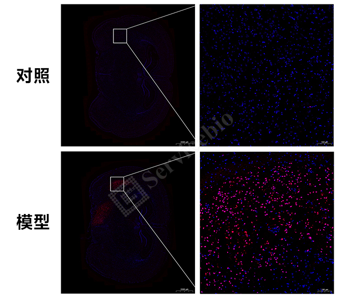 6、脑组织免疫荧光（TUNEL）.jpg