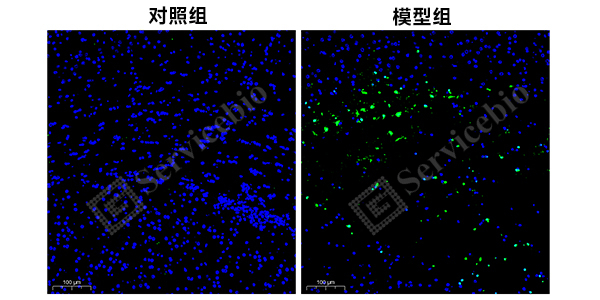 6、脑免疫荧光（Tunel）.jpg