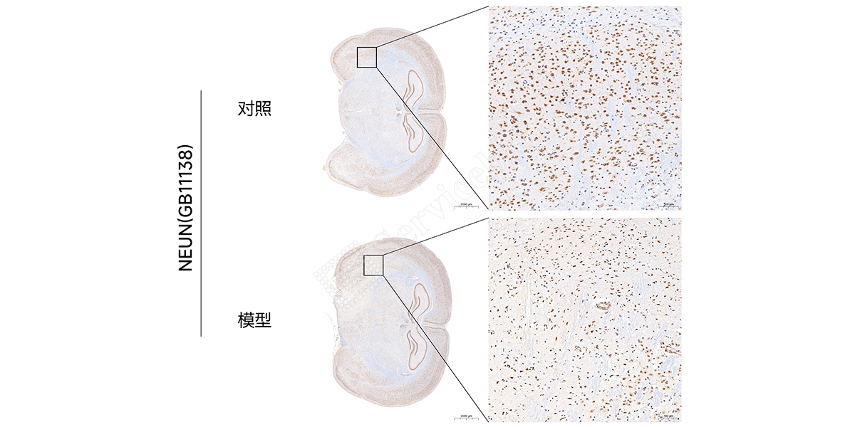 YA1128大鼠脑缺血再灌注模型.jpg