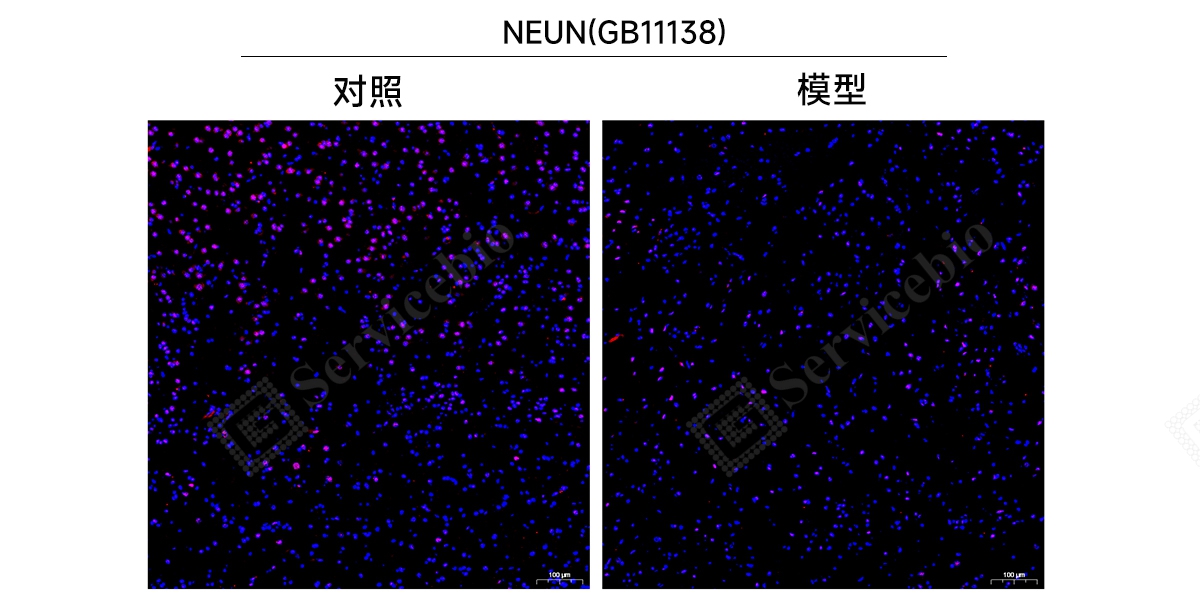 YA1128大鼠脑缺血再灌注模型IF.jpg