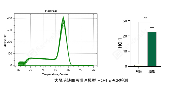 大鼠脑缺血再灌注模型 HO-1 qPCR检测3.jpg