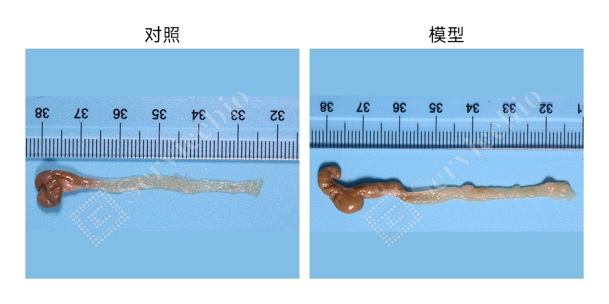 肠癌诱导模型2(1).jpg