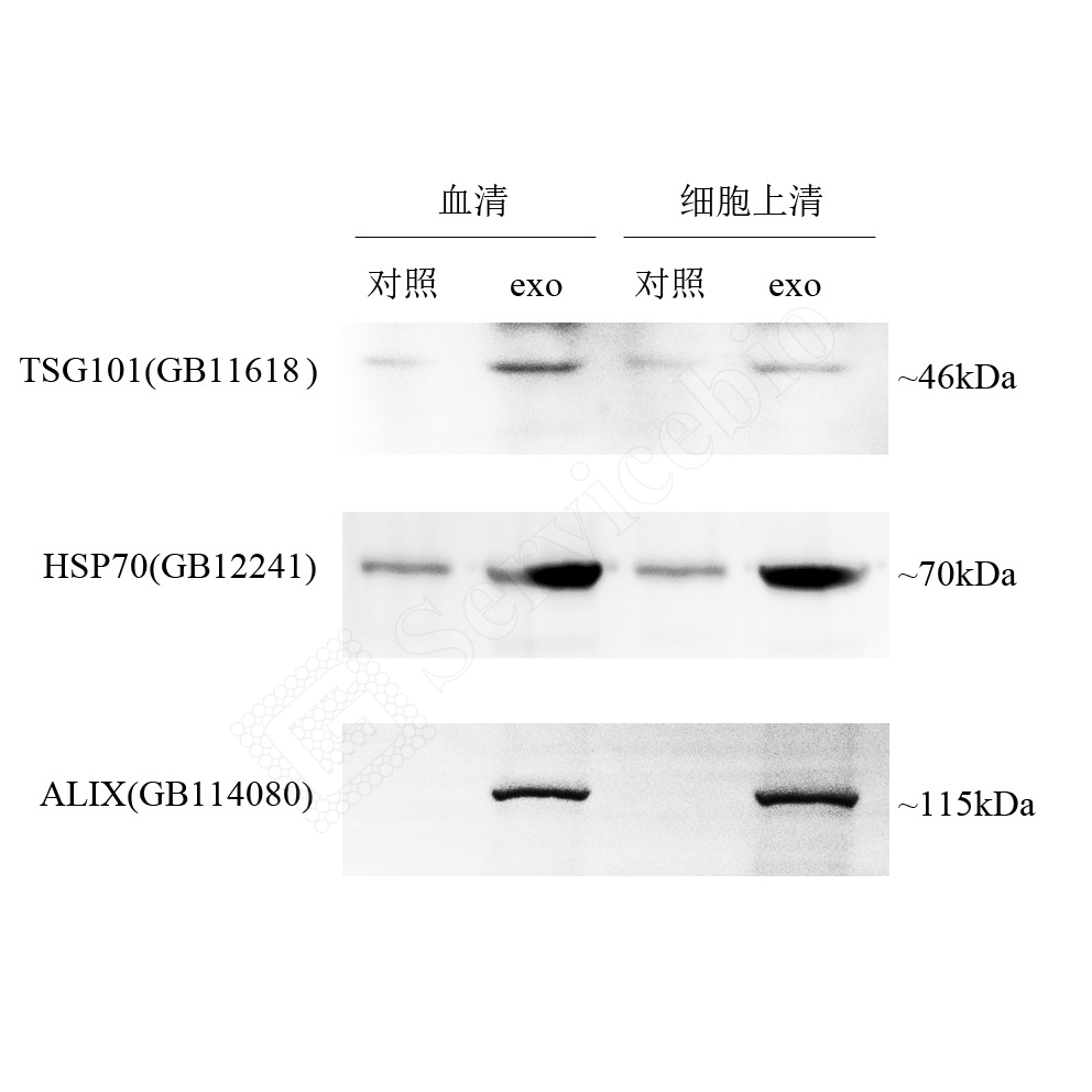 外泌体标志物GM1016-裁剪最后一条 - 副本.jpg