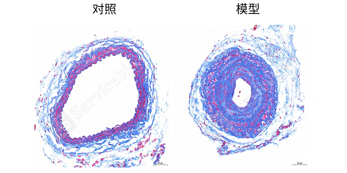 2、masson染色组图.jpg