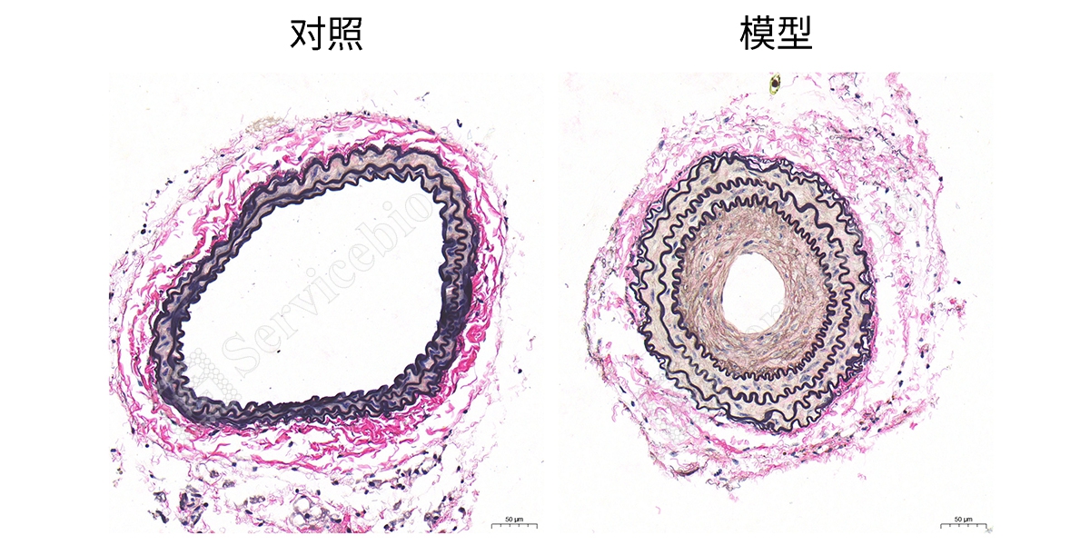 3、EVG染色组图.jpg