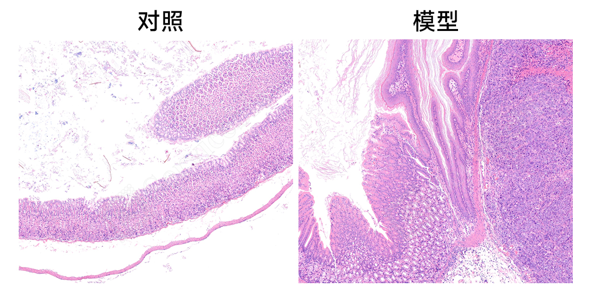 胃原位瘤 HE染色结果(1).jpg