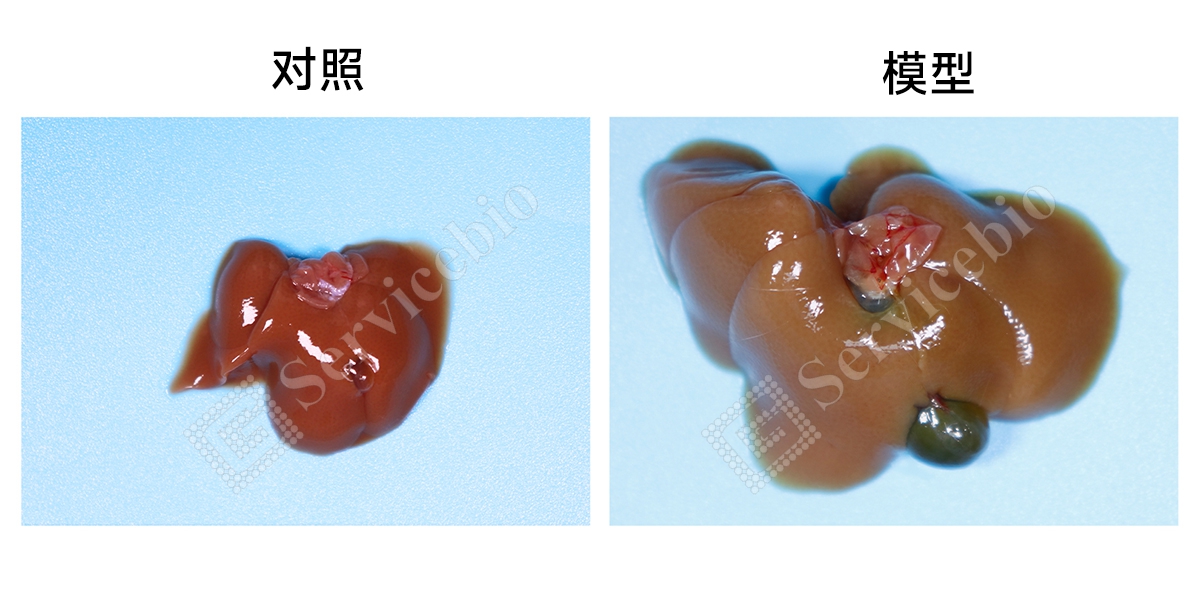 2、肝脏大体拍照.jpg
