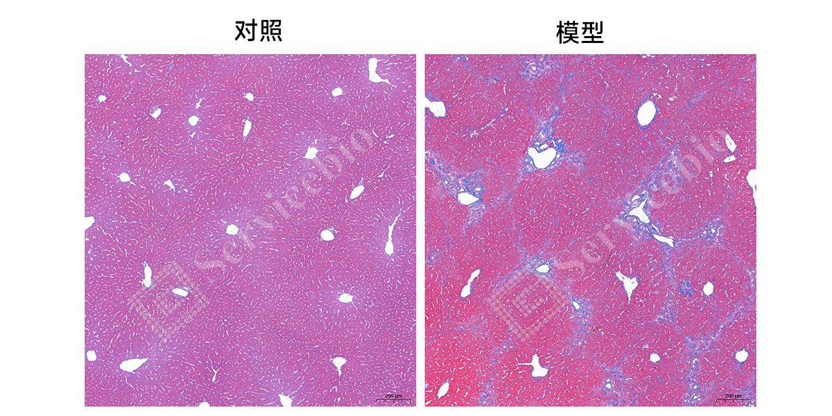 5、masson染色.jpg