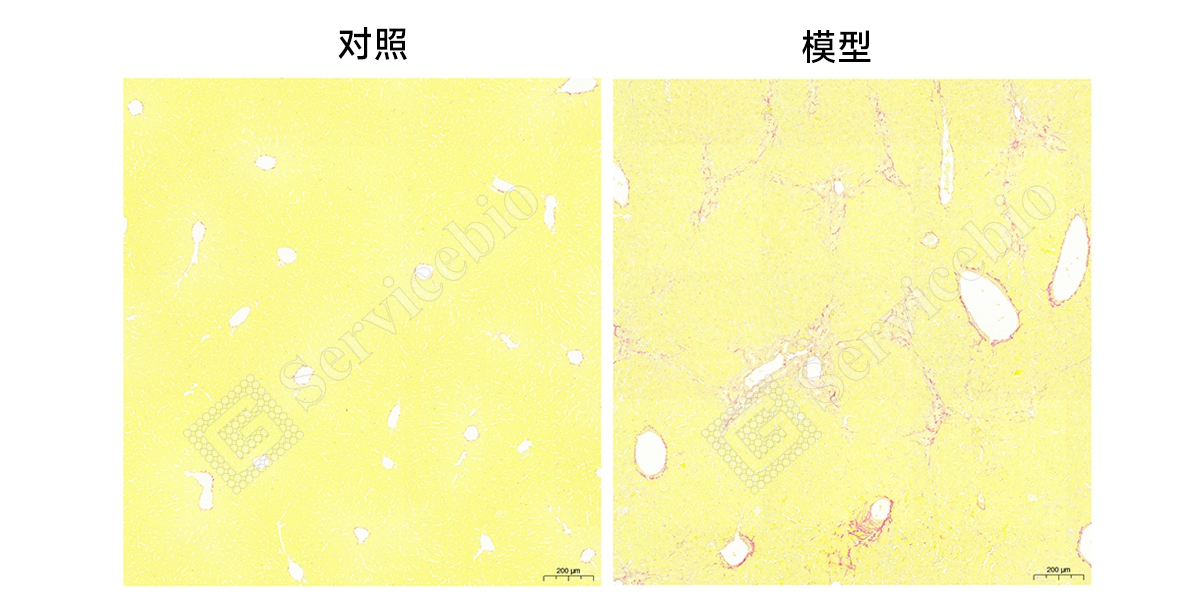 6、天狼猩红染色.jpg