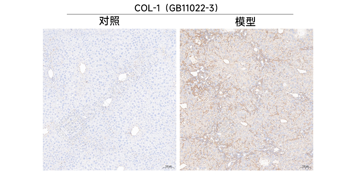 7、IHC（Collagen I）.jpg