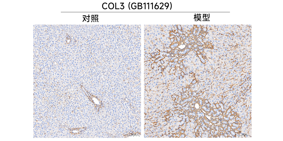 7、IHC（COL3）.jpg
