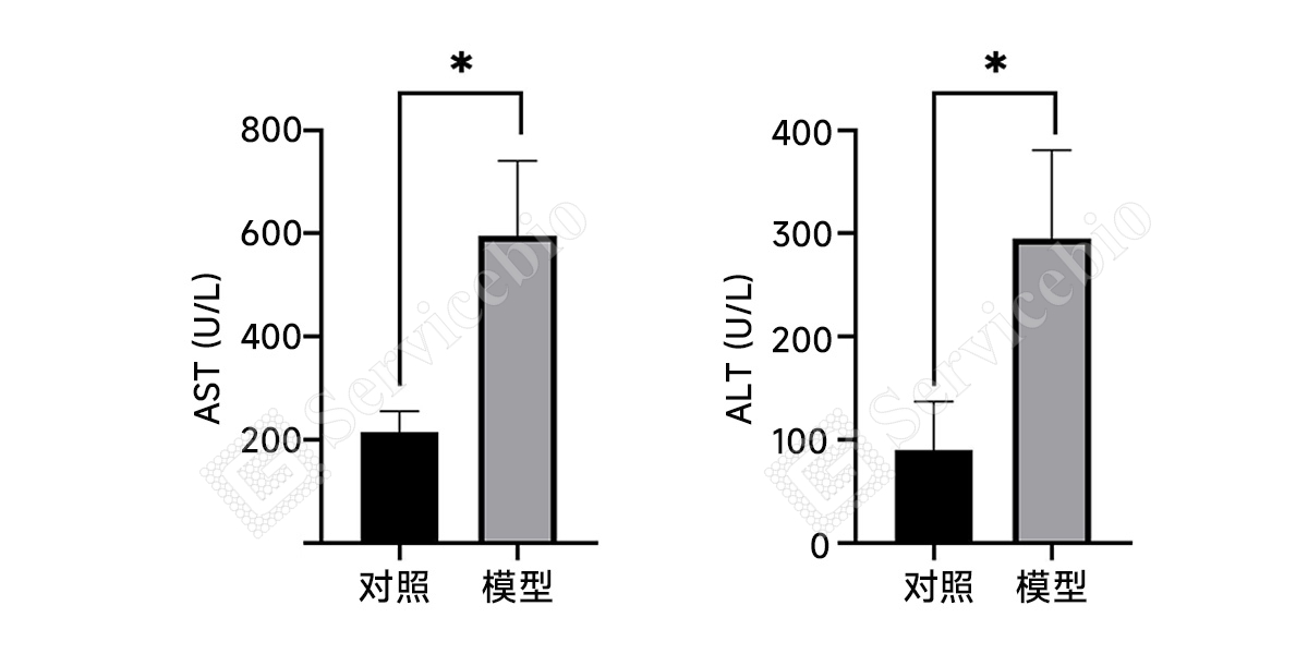 2、血清生化(AST、ALT).jpg