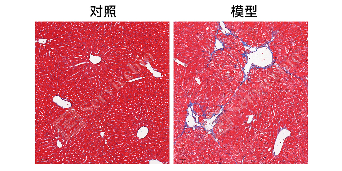4、masson染色.jpg