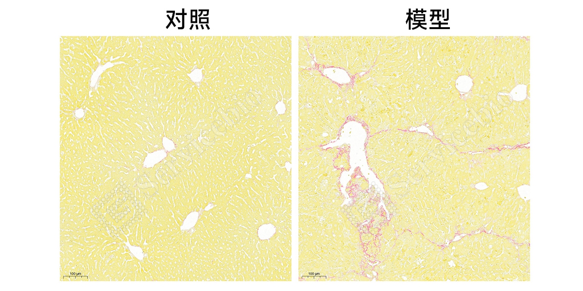 5、天狼猩红染色.jpg