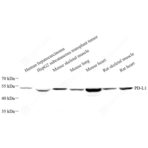 01WB1 GB11339A_PD-L1_973_d600_WB_WM - 副本.jpg
