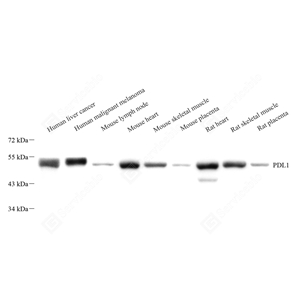 01WB2 GB11339A_PD-L1_973_d600_WB_WM - 副本.jpg