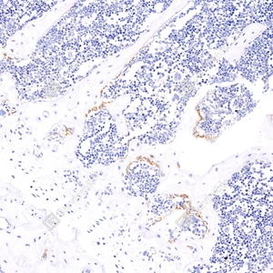 01 GB11233_Osteocalcin_S1035_S103523060701 d300 M bone_20.0x_IHC_WM.jpg