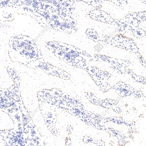 02 GB11233_GB11233_Osteocalcin_S1035_S103523060701 d300 R bone_10.0x_IHC_WM.jpg