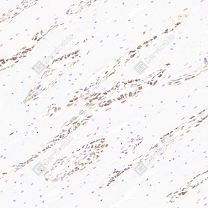 03 GB11233_Osteocalcin_S1035_S103523060701 d300 R bone_20.0x_IHC_WM.jpg