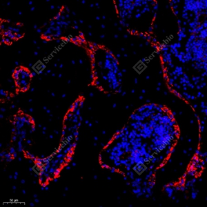 04 GB11233_Osteocalcin_red_R injured bone_d500_20.0x_IF_WM.jpg