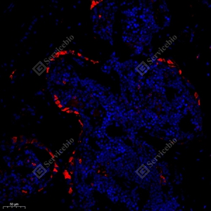 05 GB11233_Osteocalcin_red_5335_M bone_d500_20.0x_IF_WM.jpg