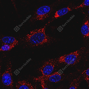 12 GB15620 CD63_D01127_D0112725051901 d2700 M NIH373_40x_ICC_WM.jpg