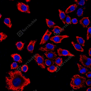 16 GB15192_Vimentin_red_ HeLa_d300_ICC_WM.jpg