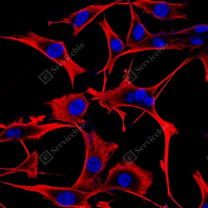17 GB15192_Vimentin_red_ NIH3T3_d300_ICC_WM.jpg