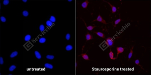 11 20240907_C-caspase7_C2609_C260922081602_d400 Hela cell_ICC_40.0x_WM - 副本.jpg