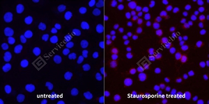 12 20240907_C-caspase7_C2609_C260922081602_d400 L6 cell_ICC_40.0x_WM - 副本.jpg
