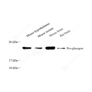 A YB113504_Pro-glucagon_581_d800_WB_WM.jpg