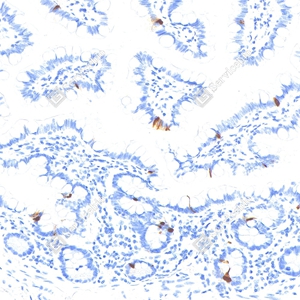 07 YB115778_Pro-glucagon_CB091_CB09124100103_d1000_H small intestine_20.0x_IHC_WM.jpg