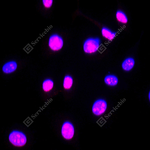 08 GB111499_Ki67_red_d200_HeLa_20x_ICC_WM.jpg