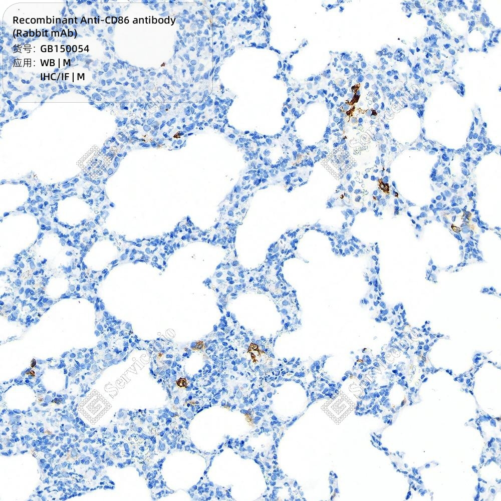 CD97 (Q14) Rabbit mAb main image 1