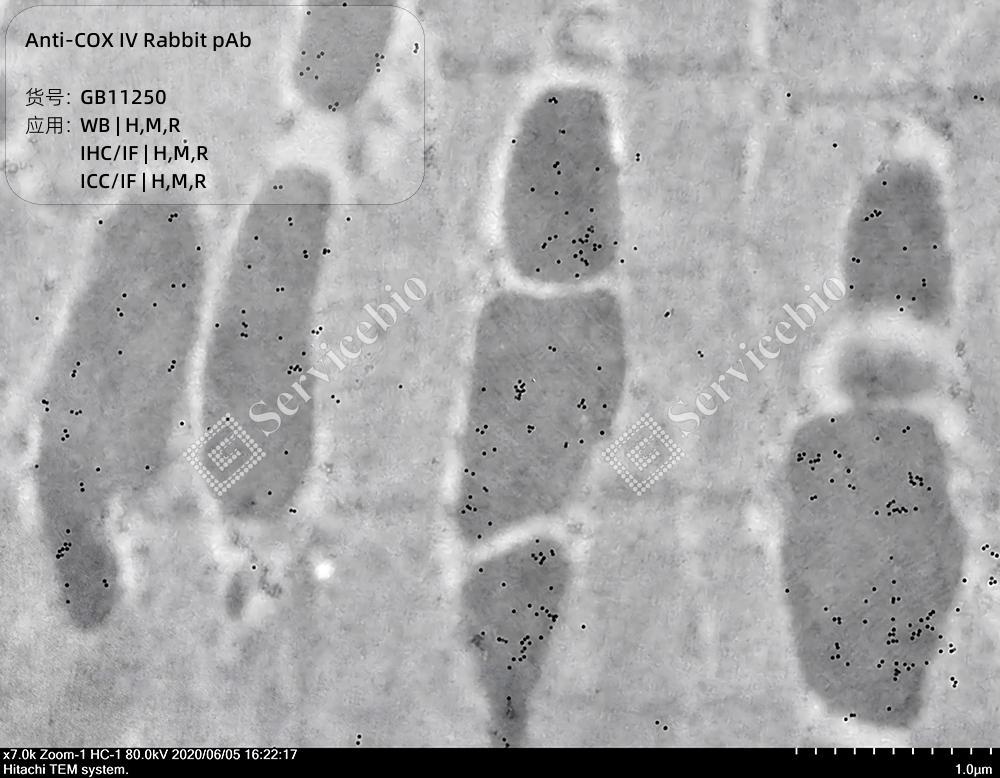赛维尔生物服务|产品_Servicebio_武汉赛维尔生物科技有限公司