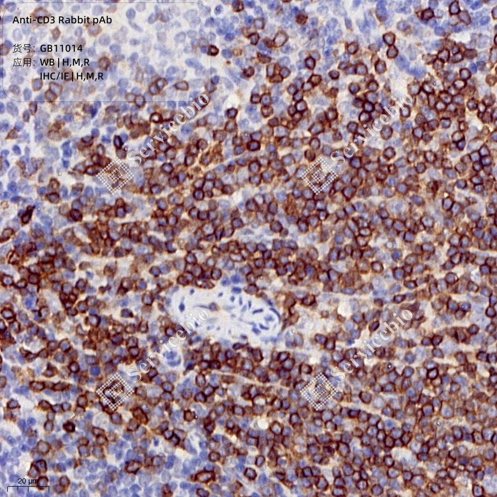 CD103 (Z11) Rabbit mAb