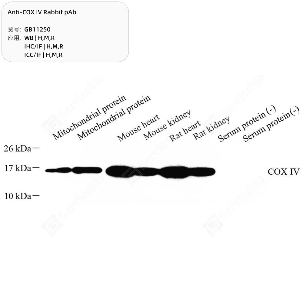 赛维尔生物服务|产品_Servicebio_武汉赛维尔生物科技有限公司