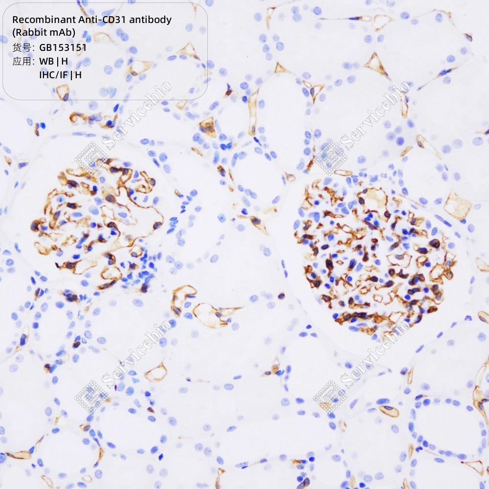 Phospho-CD31 (Tyr713) (A10) Rabbit mAb main image 1